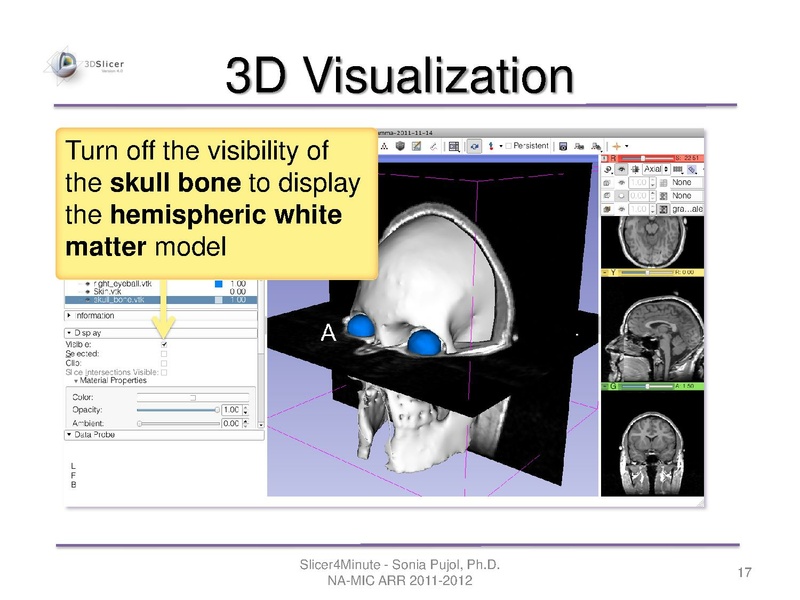 File:Slicer4minute-tutorial SoniaPujol-mj.pdf