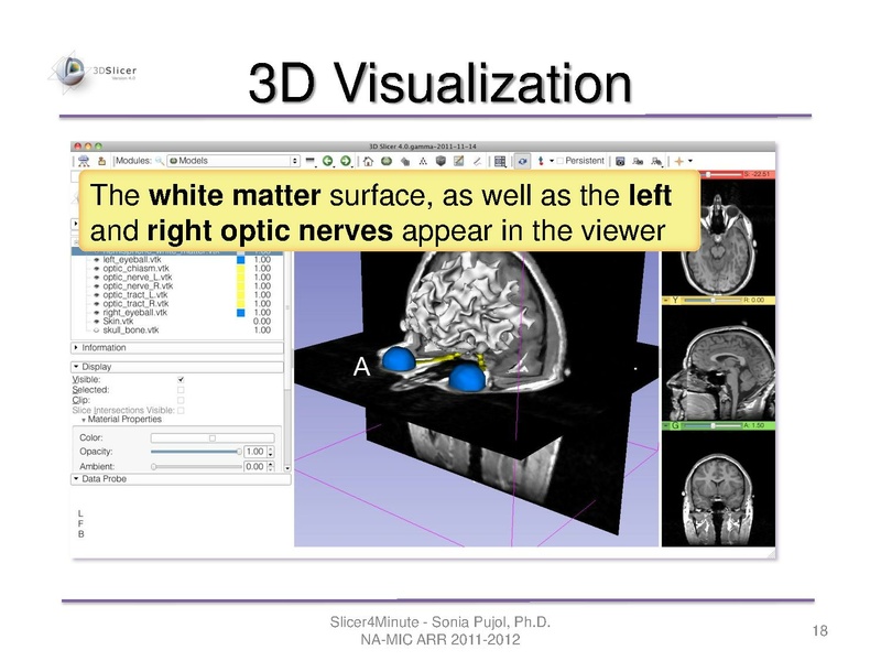 File:Slicer4minute-tutorial SoniaPujol-mj.pdf