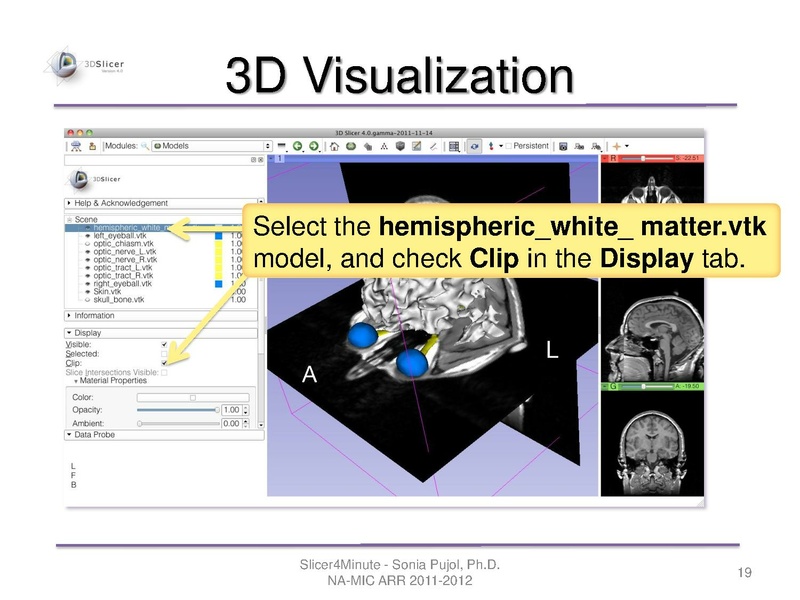 File:Slicer4minute-tutorial SoniaPujol-mj.pdf