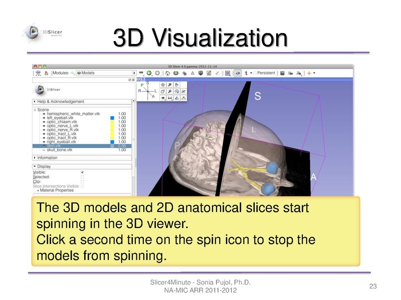 File:Slicer4minute-tutorial SoniaPujol-mj.pdf