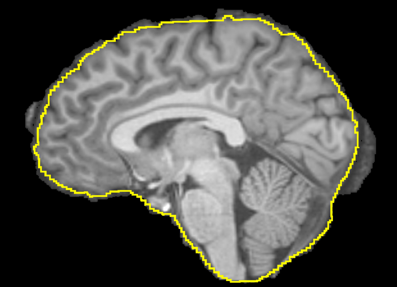 File:T1 BET BVeR.png