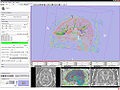 Thumbnail for version as of 18:15, 24 April 2008
