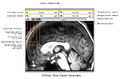 Thumbnail for version as of 14:45, 29 February 2008