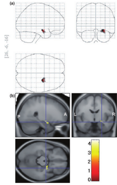 File:PCN hayano-fig2.png