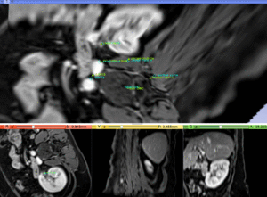 RegLib C48 registered.gif