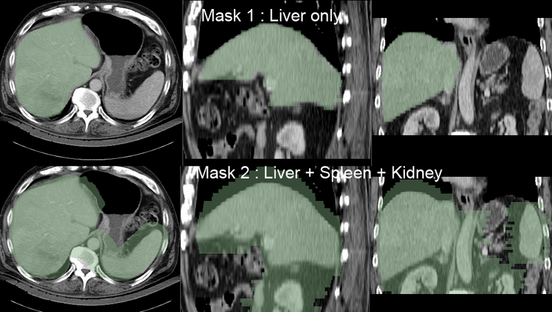 File:RegLib C12 Masks.png