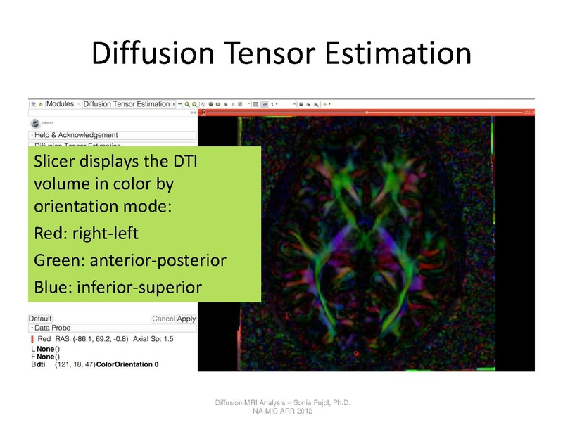 File:DTI Analysis Tutorial SoniaPujol.pdf