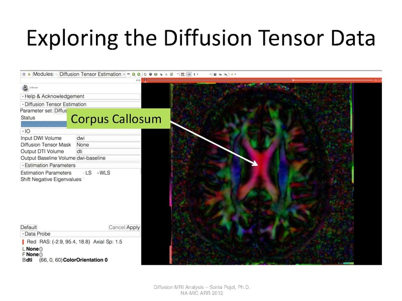 File:DTI Analysis Tutorial SoniaPujol.pdf
