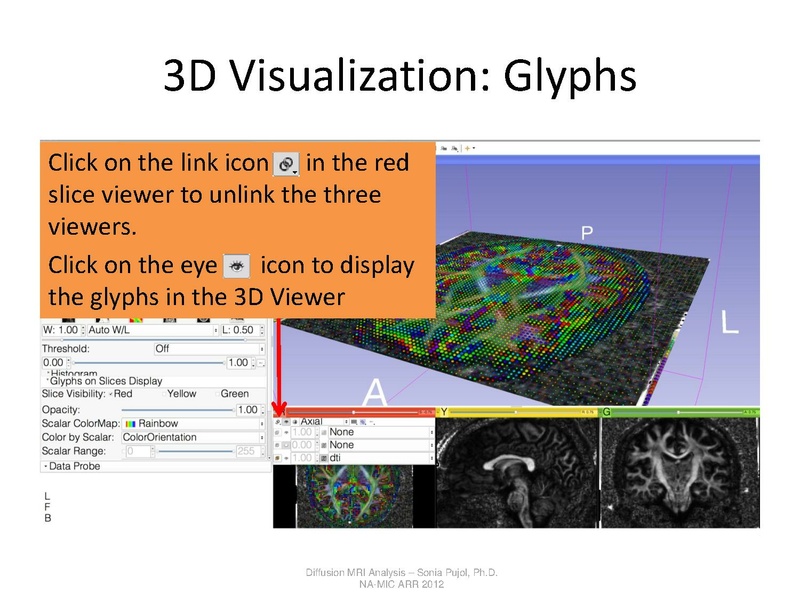 File:DTI Analysis Tutorial SoniaPujol.pdf