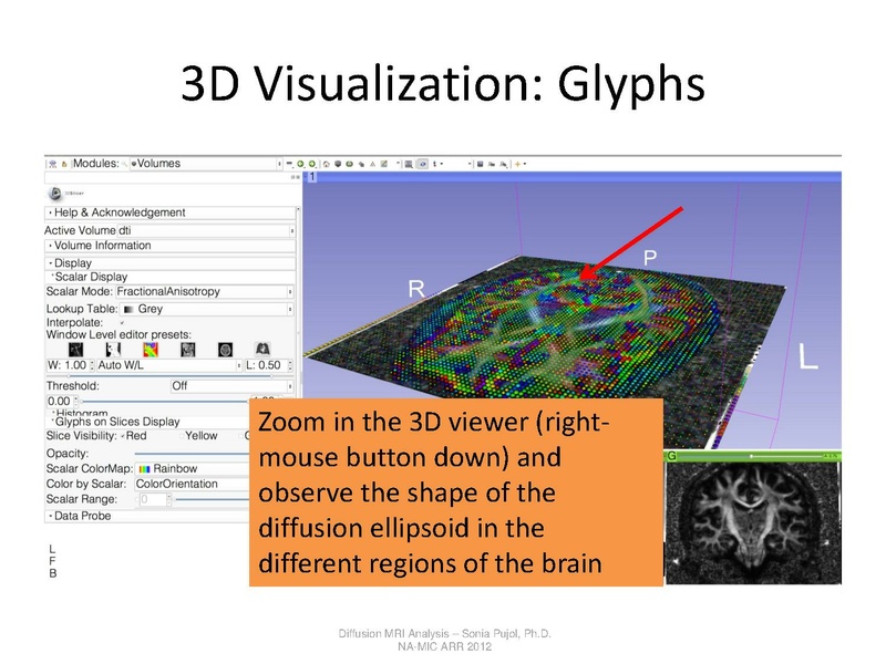 File:DTI Analysis Tutorial SoniaPujol.pdf