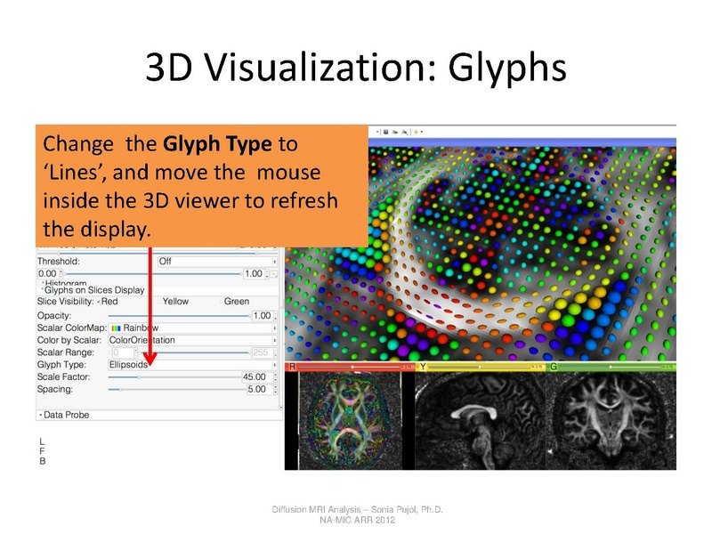 File:DTI Analysis Tutorial SoniaPujol.pdf