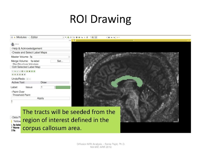 File:DTI Analysis Tutorial SoniaPujol.pdf