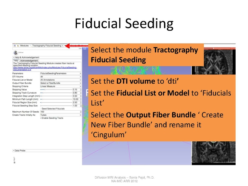 File:DTI Analysis Tutorial SoniaPujol.pdf