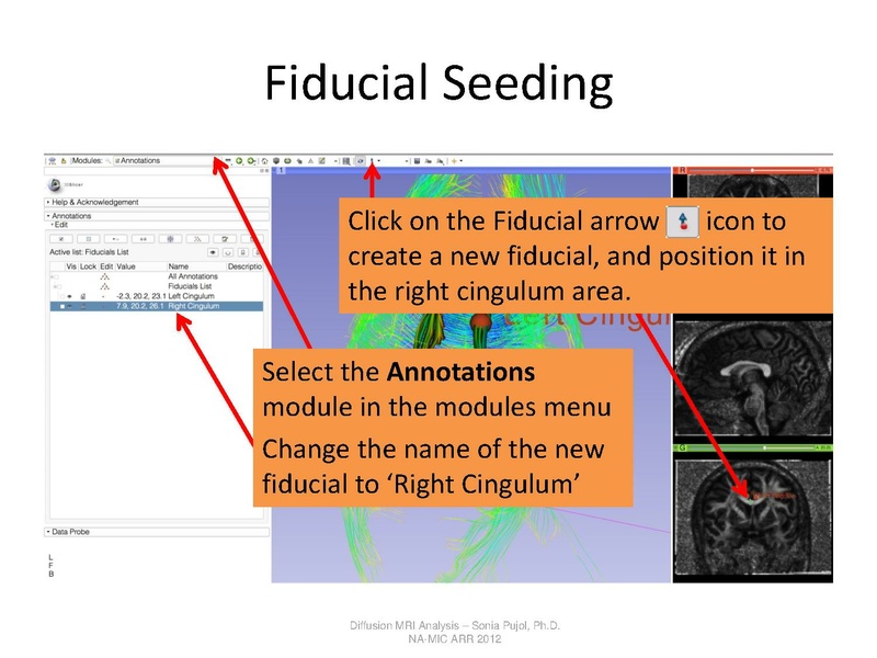 File:DTI Analysis Tutorial SoniaPujol.pdf