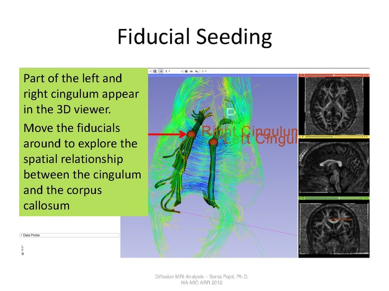 File:DTI Analysis Tutorial SoniaPujol.pdf