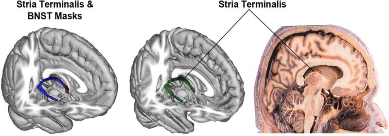 File:Avery-Neuroimage2014-fig3.png