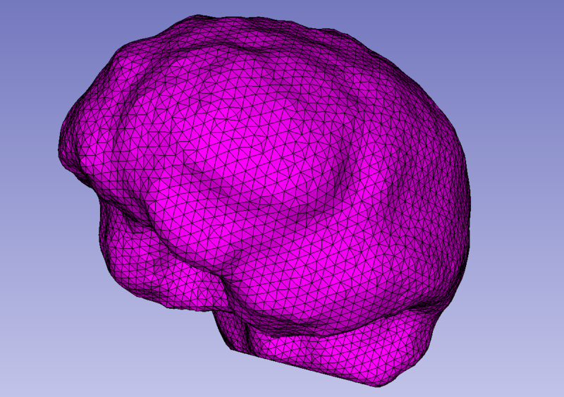 File:Brain after.jpg