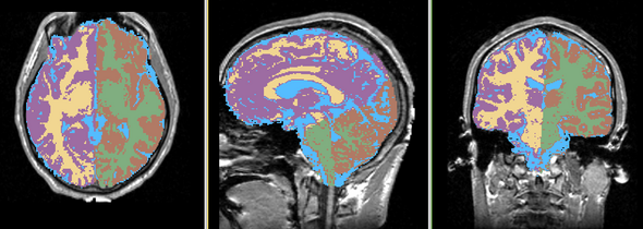 EMS Hemisphere labelmap.png