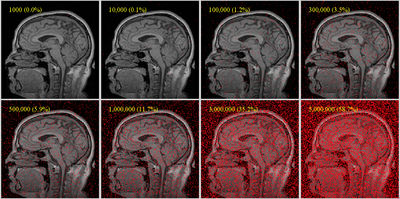 sample point densities on one slice of a brain MRI with 256x256x130 voxels; useful coverage requires at least 5% coverage for affine, more as DOF increase