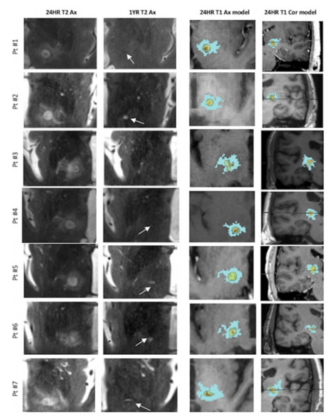 File:Harary-Neurosurg Focus. 2018-fig1.png
