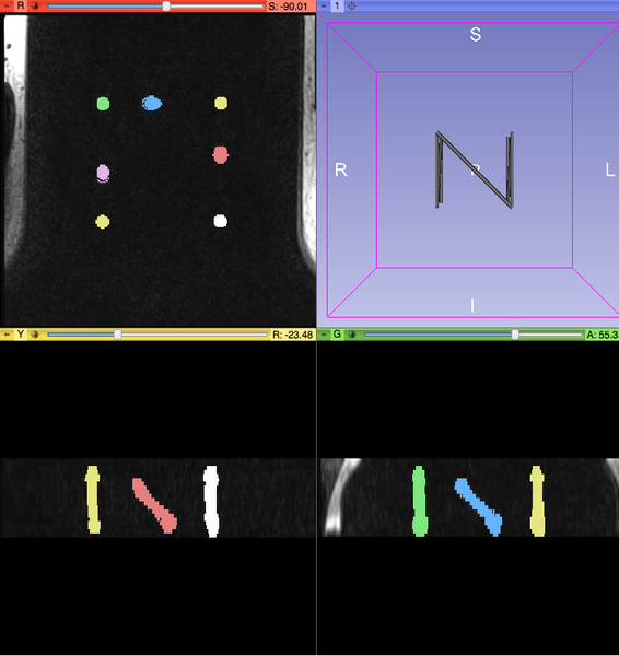 File:LineMarkerRegistration Screenshot Segmented.png