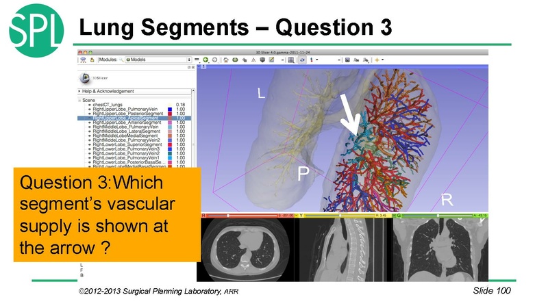 File:3DVisualizationDICOM RadiologyApplications SoniaPujol KittShaffer RSNA2012.pdf