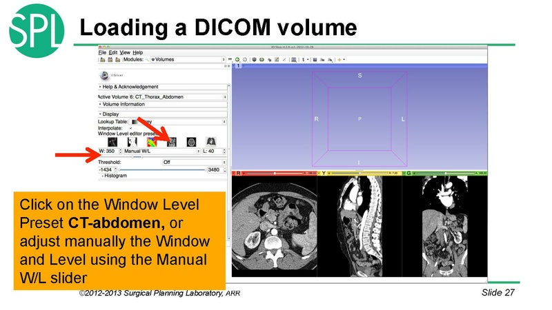 File:3DVisualizationDICOM RadiologyApplications SoniaPujol KittShaffer RSNA2012.pdf