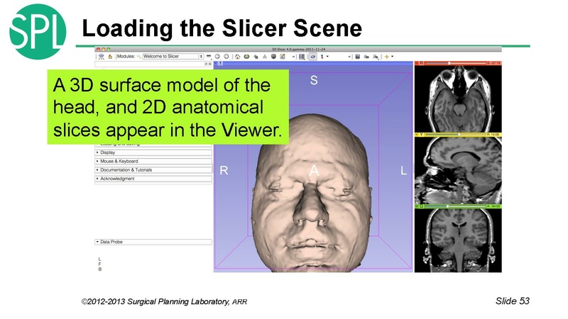 File:3DVisualizationDICOM RadiologyApplications SoniaPujol KittShaffer RSNA2012.pdf