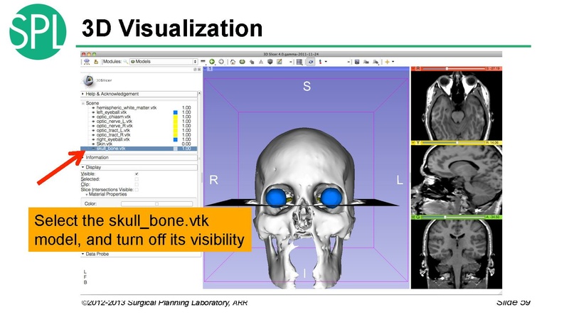 File:3DVisualizationDICOM RadiologyApplications SoniaPujol KittShaffer RSNA2012.pdf