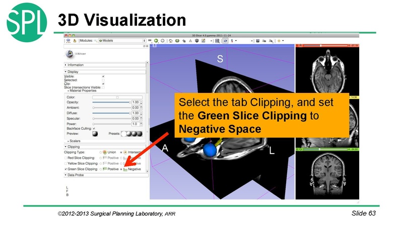 File:3DVisualizationDICOM RadiologyApplications SoniaPujol KittShaffer RSNA2012.pdf