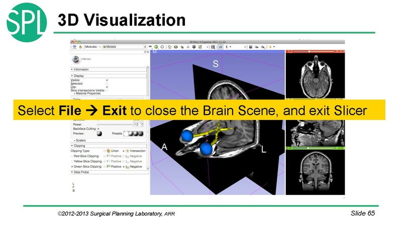 File:3DVisualizationDICOM RadiologyApplications SoniaPujol KittShaffer RSNA2012.pdf