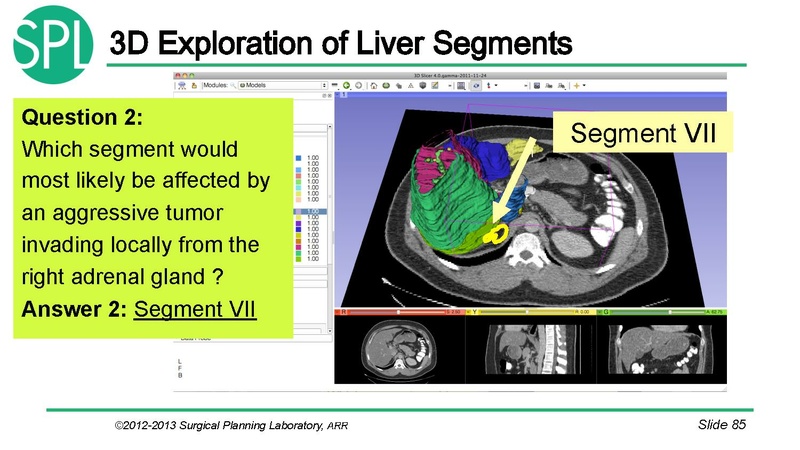 File:3DVisualizationDICOM RadiologyApplications SoniaPujol KittShaffer RSNA2012.pdf