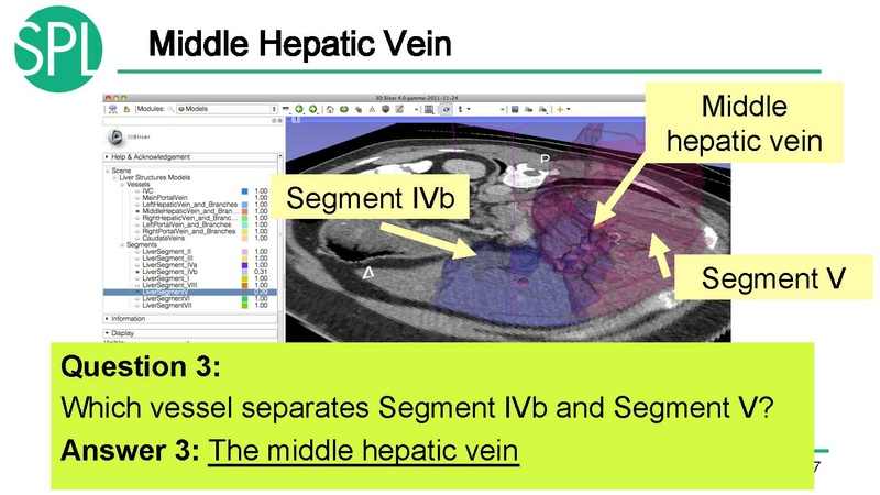 File:3DVisualizationDICOM RadiologyApplications SoniaPujol KittShaffer RSNA2012.pdf