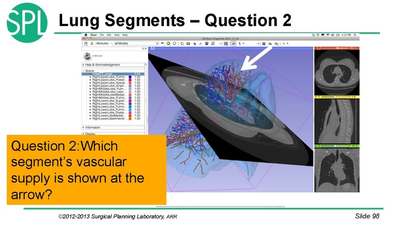 File:3DVisualizationDICOM RadiologyApplications SoniaPujol KittShaffer RSNA2012.pdf