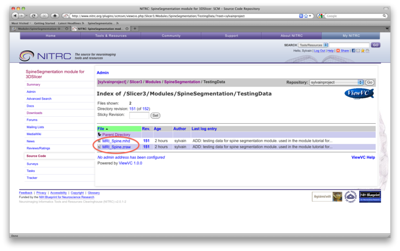 File:SpineSegmentation Slicer3.6 documentation00.png