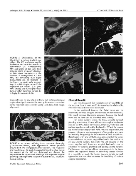 File:Bartling-JComputAssistTomogr2005.pdf