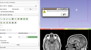 Documentation/Nightly/Developers/EditorExtension - Slicer Wiki