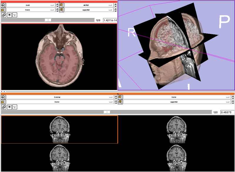 File:VisualizationTutorial 3.6RC3.png