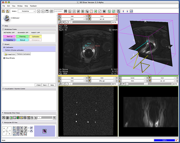 File:ProstateModule-3.4.jpg