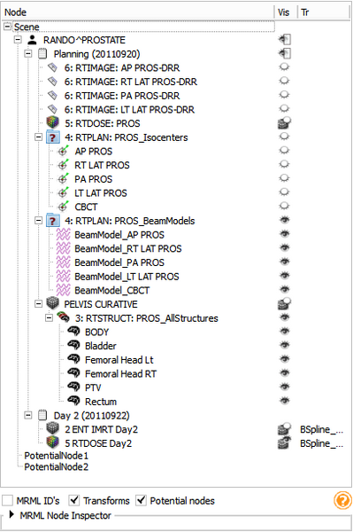 File:Slicer4.4 SubjectHierarchy Prostate.png