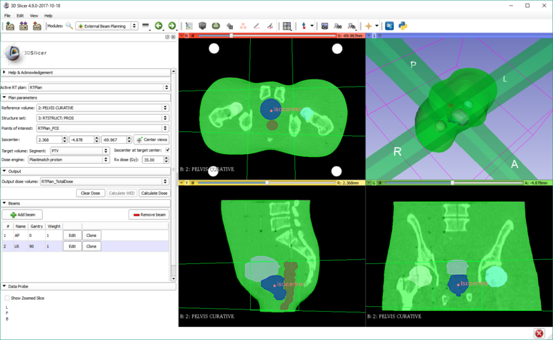 File:20171019 EBP ProstateProton Planning.png