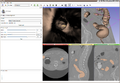 3D Slicer 4.0.gamma-2011-10-20 141.png