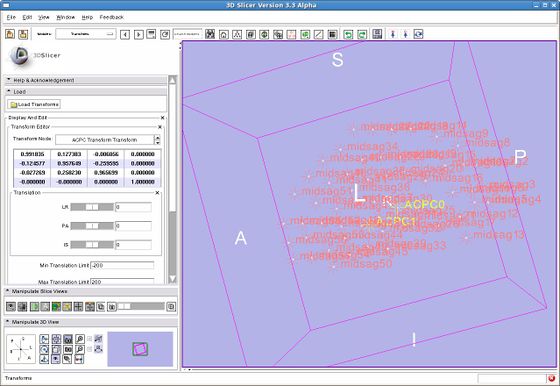 Modules:ACPCTransform-Documentation-3.6 - Slicer Wiki