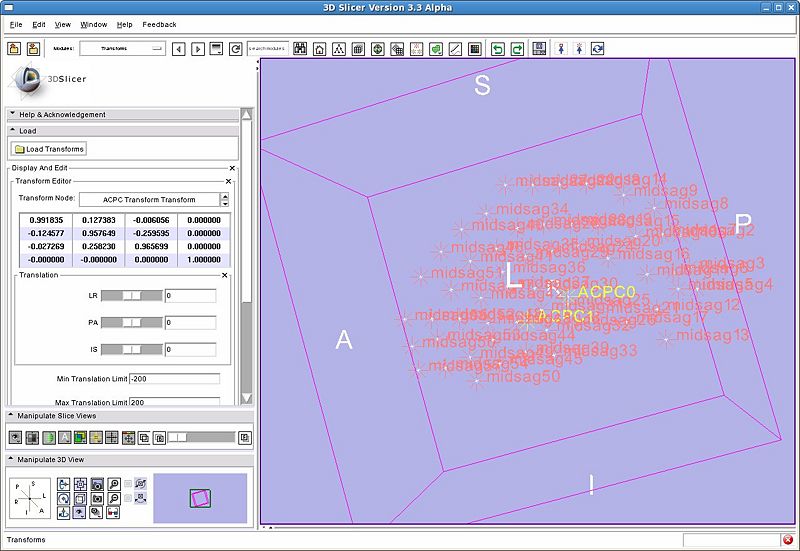 File:SlicerACPCTransformAfter-3.4.jpg