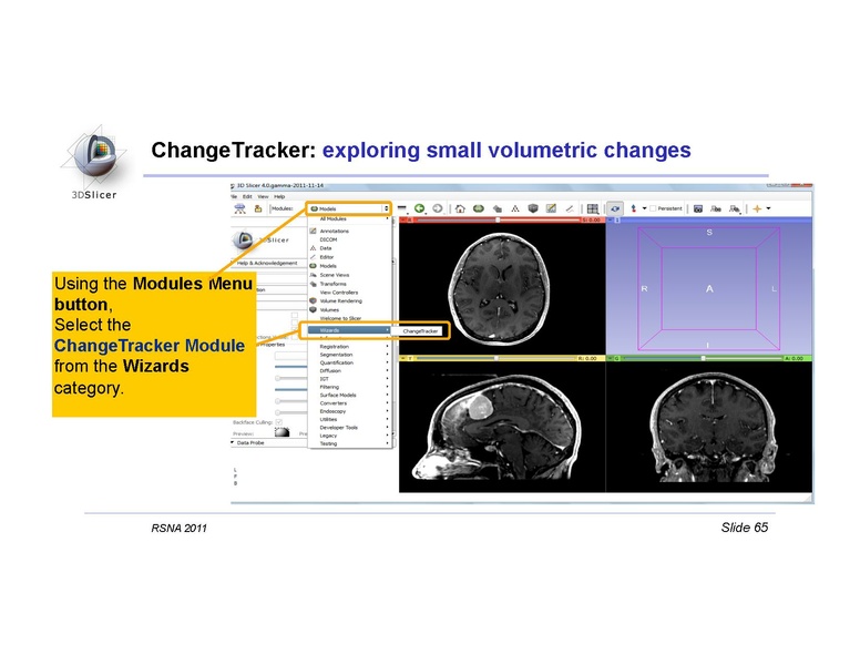 File:Slicer4QuantitativeImaging.pdf