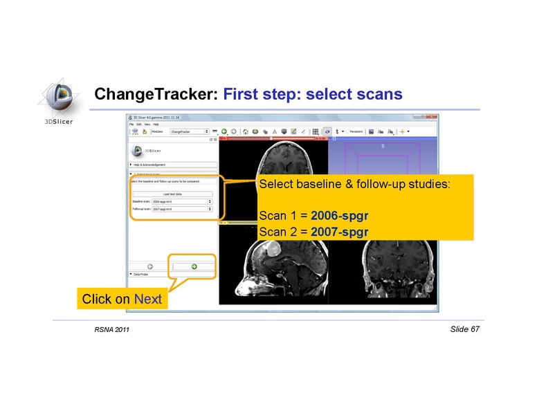 File:Slicer4QuantitativeImaging.pdf