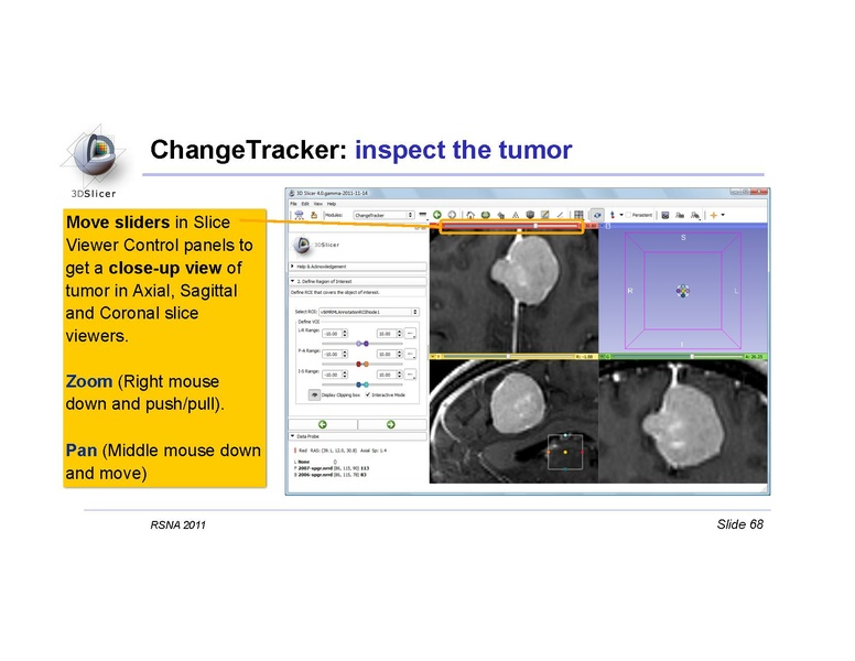 File:Slicer4QuantitativeImaging.pdf