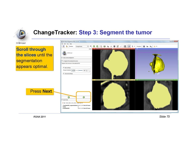 File:Slicer4QuantitativeImaging.pdf