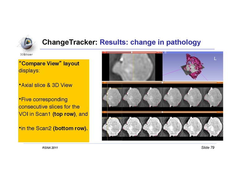 File:Slicer4QuantitativeImaging.pdf