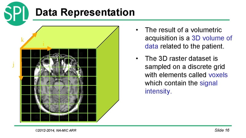 File:DataLoadingAndVisualizationSlicer4.1 SoniaPujol.pdf